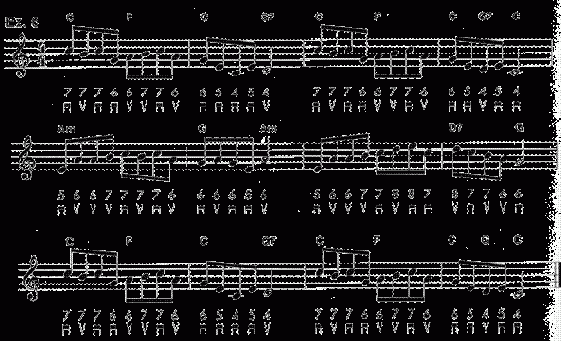 KISS THE BLARNEY STONE (SOLO)