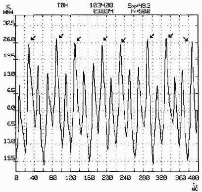 Практическая вибродиагностика