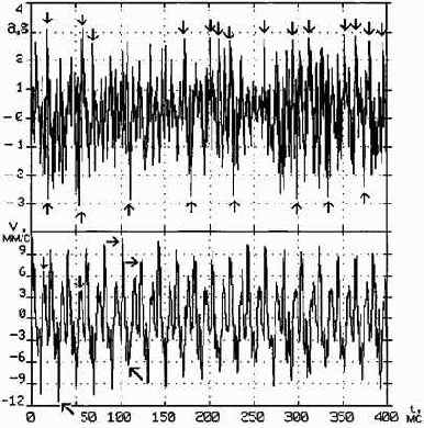 Практическая вибродиагностика