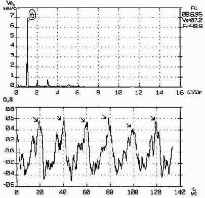 Практическая вибродиагностика