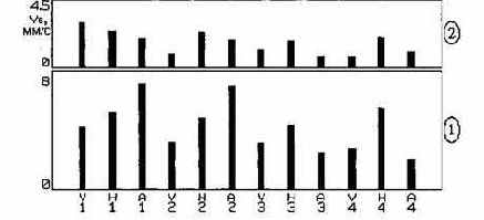 Практическая вибродиагностика