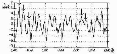Практическая вибродиагностика