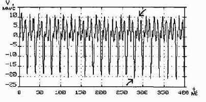 Практическая вибродиагностика