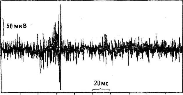 ����� ��������?