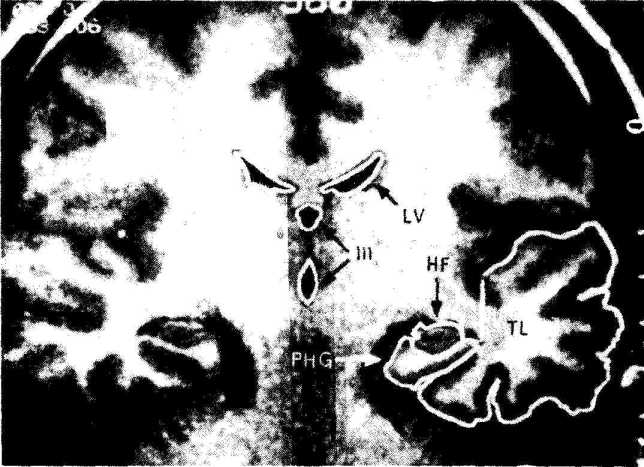 �������� ���� ������