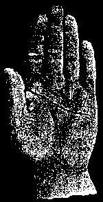 Короткая рестрикта обозначает несчастье и бедность.