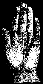 Короткая рестрикта обозначает несчастье и бедность.