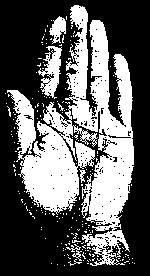 Короткая рестрикта обозначает несчастье и бедность.