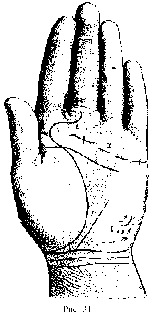 Измерение руки (хирометрия)