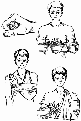 ������ ����������� ������