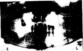 ��������� -������������ �������� ���