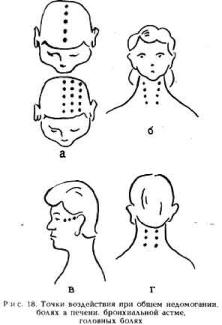 �������� - ������� ��������� �������