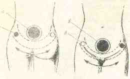 �������� - ����� �������� � ���������