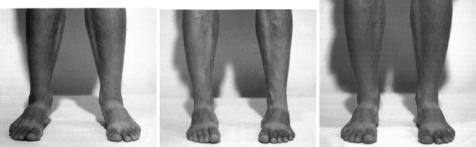 ������� �����