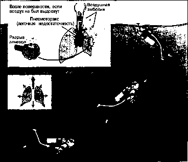 ������ - ���������� ������