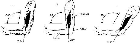 ������ - ���������� ������