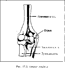 ������ - ���������� ������