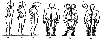 ���������� - �������� ���������� �������� (�������������)