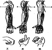 ���������� - �������� ���������� �������� (�������������)