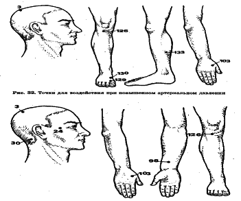 ���������� - �������� ���������� �������� (�������������)