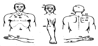 ���������� - �������� ���������� �������� (�������������)