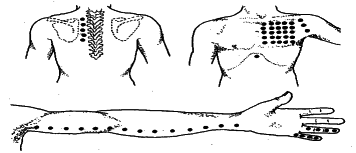 ���������� - �������� ���������� �������� (�������������)