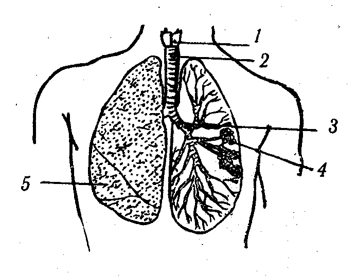 ������� - ���������� �������� ��������