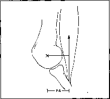 ����� - ����������� ����������� ���������������� �������