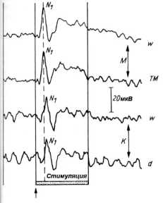 ������������� ���� ��� ���������