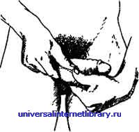 ������ - �������� ������� �����