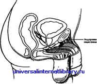 ������ - �������� ������� �����