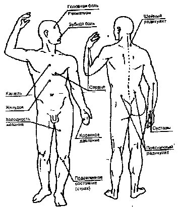 �������� - ����-��������� ����� ����������