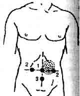 �������� - ����-��������� ����� ����������