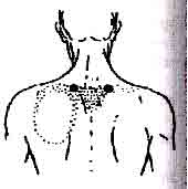 �������� - ����-��������� ����� ����������