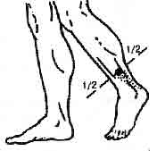 �������� - ����-��������� ����� ����������