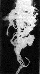 ������� �. - ���������? ��� ��� �����!!!